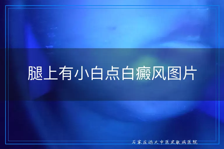 腿上有小白点白癜风图片