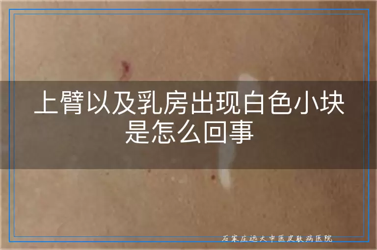 上臂以及乳房出现白色小块是怎么回事