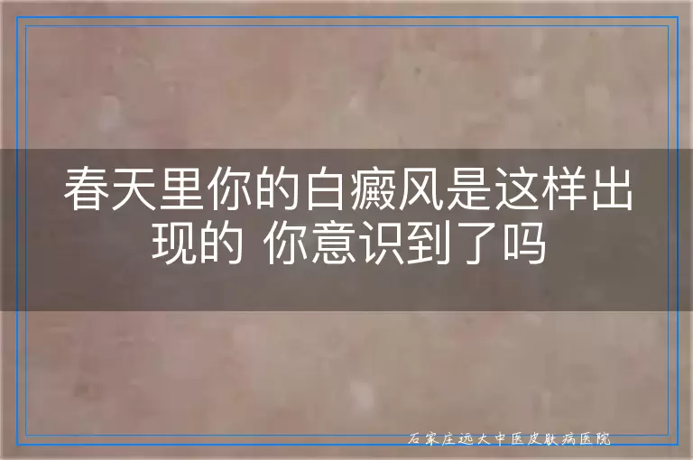 春天里你的白癜风是这样出现的 你意识到了吗