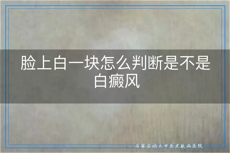 脸上白一块怎么判断是不是白癜风