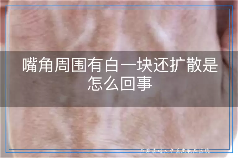 嘴角周围有白一块还扩散是怎么回事