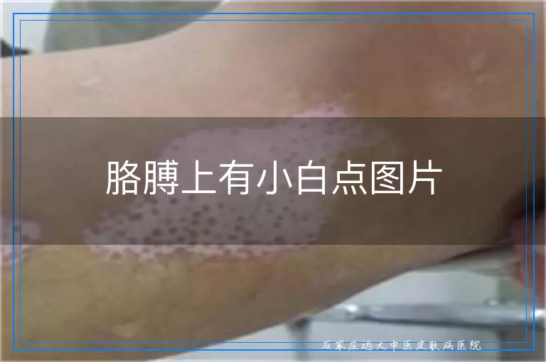 胳膊上有小白点图片