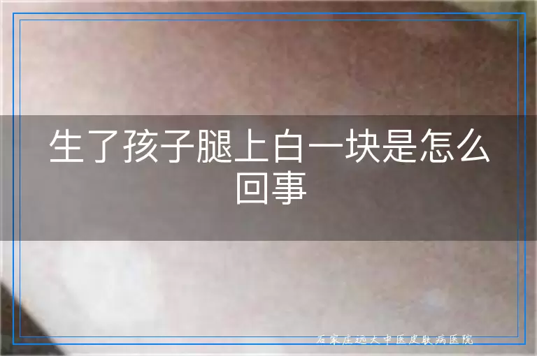 生了孩子腿上白一块是怎么回事