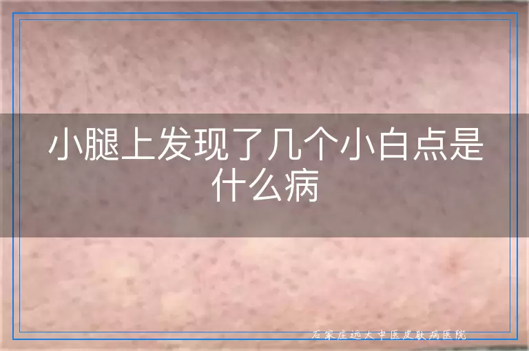 小腿上发现了几个小白点是什么病
