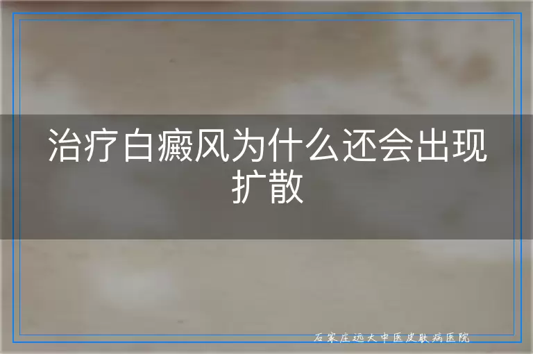 治疗白癜风为什么还会出现扩散
