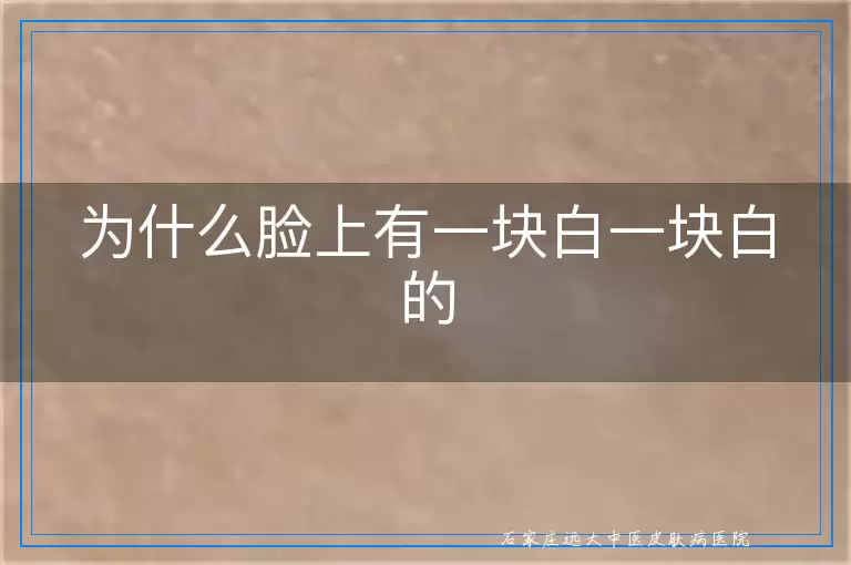 为什么脸上有一块白一块白的