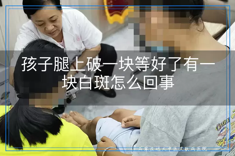 孩子腿上破一块等好了有一块白斑怎么回事