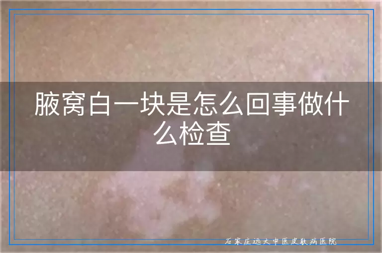 腋窝白一块是怎么回事做什么检查