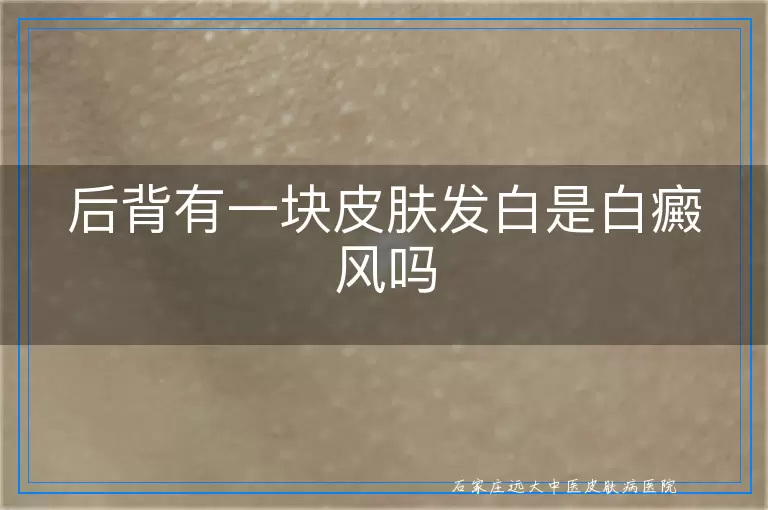 后背有一块皮肤发白是白癜风吗