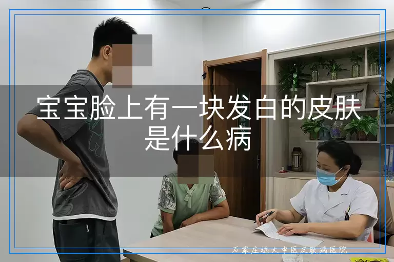 宝宝脸上有一块发白的皮肤是什么病
