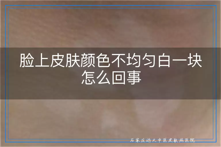 脸上皮肤颜色不均匀白一块怎么回事