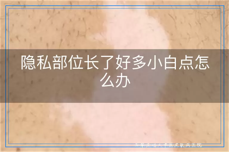 隐私部位长了好多小白点怎么办