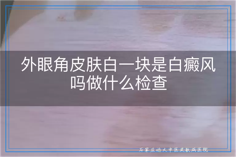 外眼角皮肤白一块是白癜风吗做什么检查