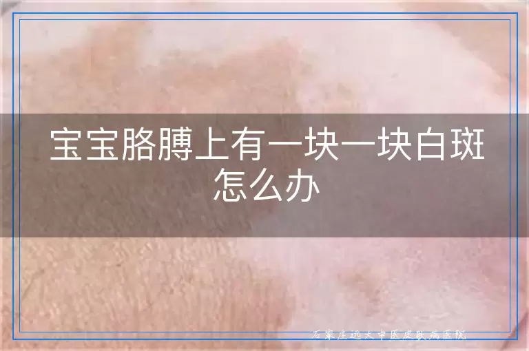 宝宝胳膊上有一块一块白斑怎么办