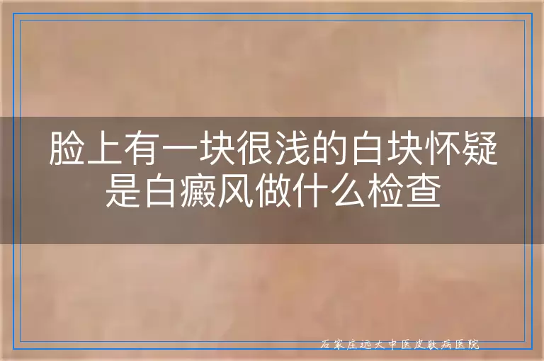 脸上有一块很浅的白块怀疑是白癜风做什么检查