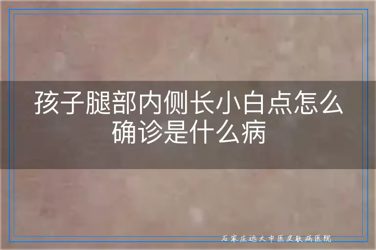 孩子腿部内侧长小白点怎么确诊是什么病