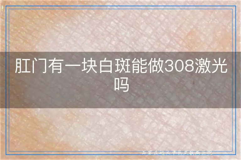 肛门有一块白斑能做308激光吗