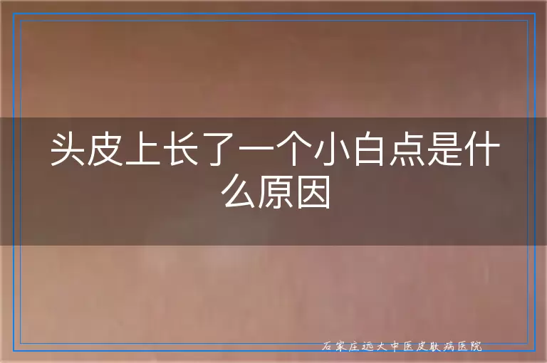 头皮上长了一个小白点是什么原因