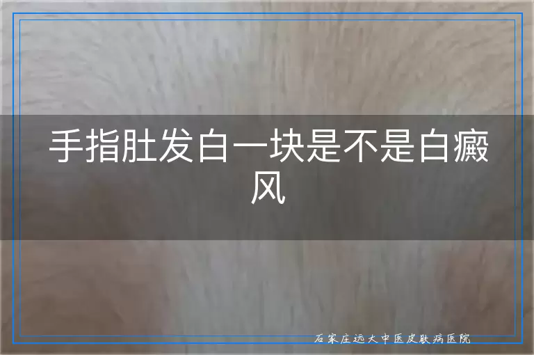 手指肚发白一块是不是白癜风