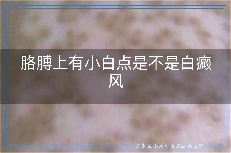胳膊上有小白点是不是白癜风