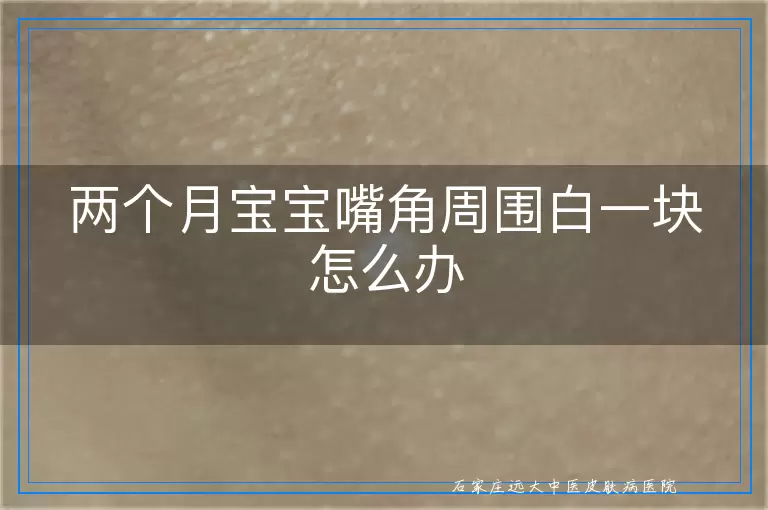 两个月宝宝嘴角周围白一块怎么办