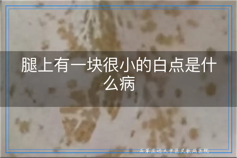 腿上有一块很小的白点是什么病