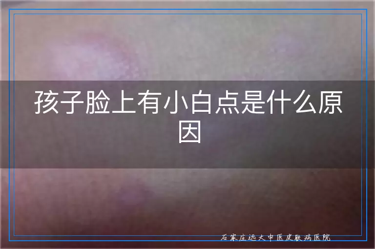 孩子脸上有小白点是什么原因