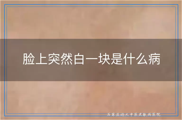 脸上突然白一块是什么病