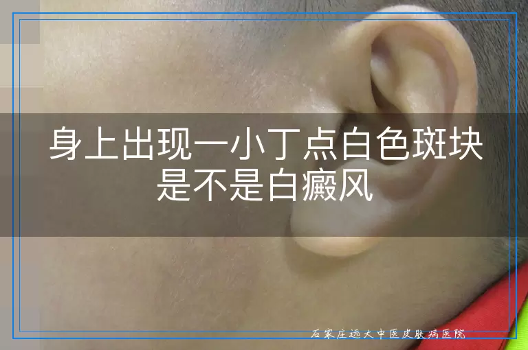 身上出现一小丁点白色斑块是不是白癜风
