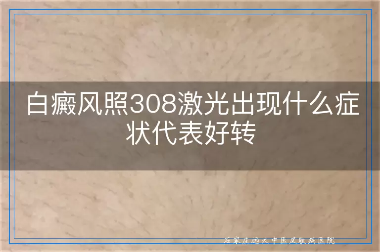 白癜风照308激光出现什么症状代表好转
