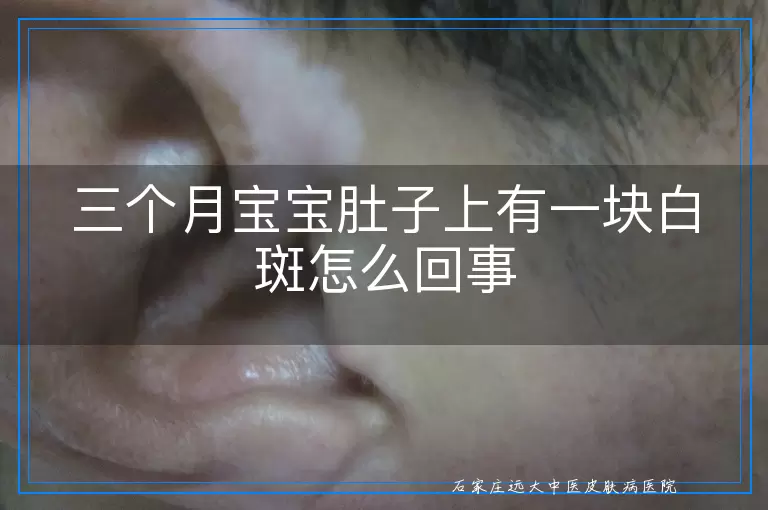 三个月宝宝肚子上有一块白斑怎么回事