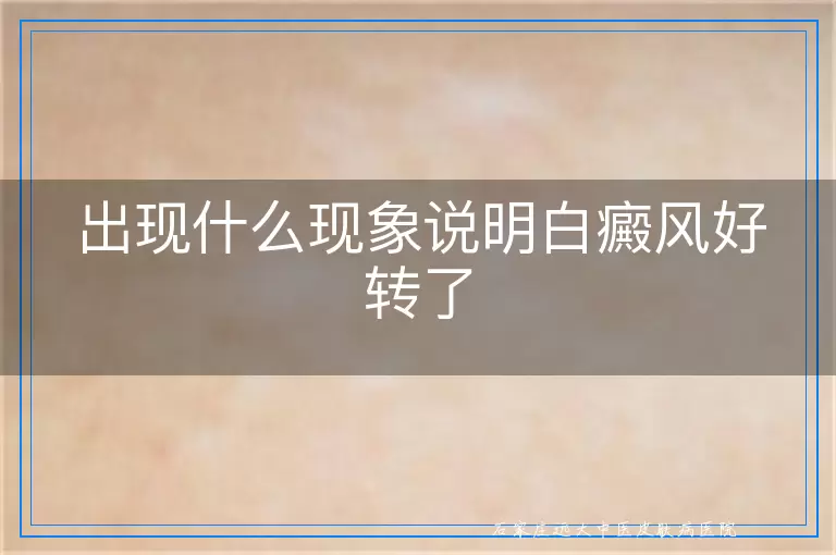 出现什么现象说明白癜风好转了