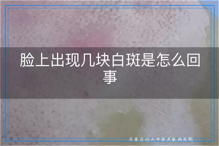 脸上出现几块白斑是怎么回事