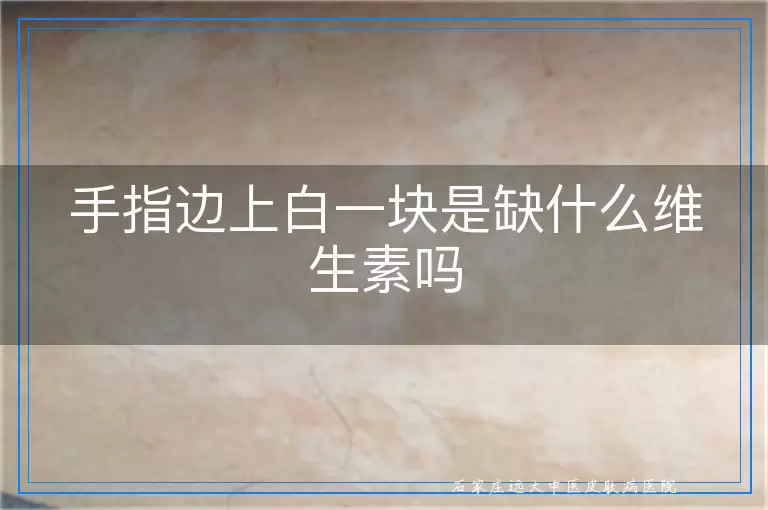手指边上白一块是缺什么维生素吗
