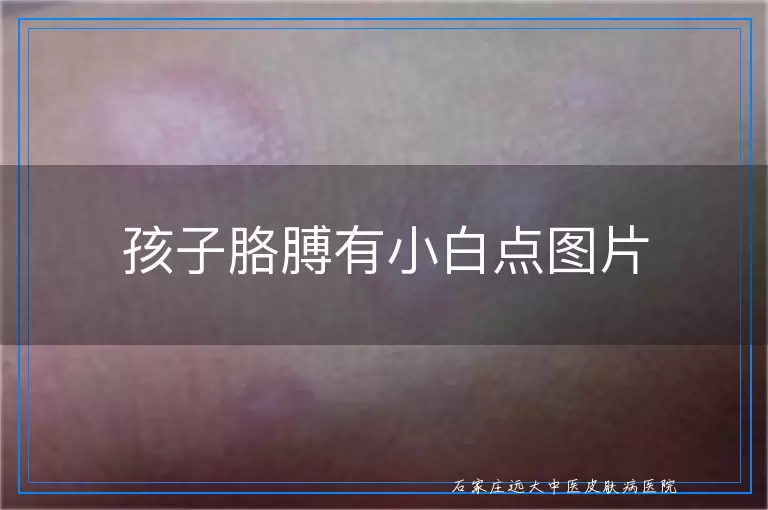 孩子胳膊有小白点图片