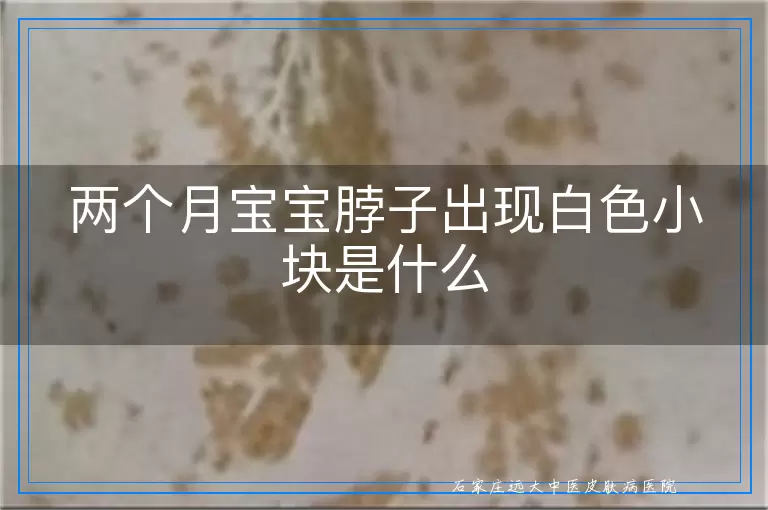 两个月宝宝脖子出现白色小块是什么