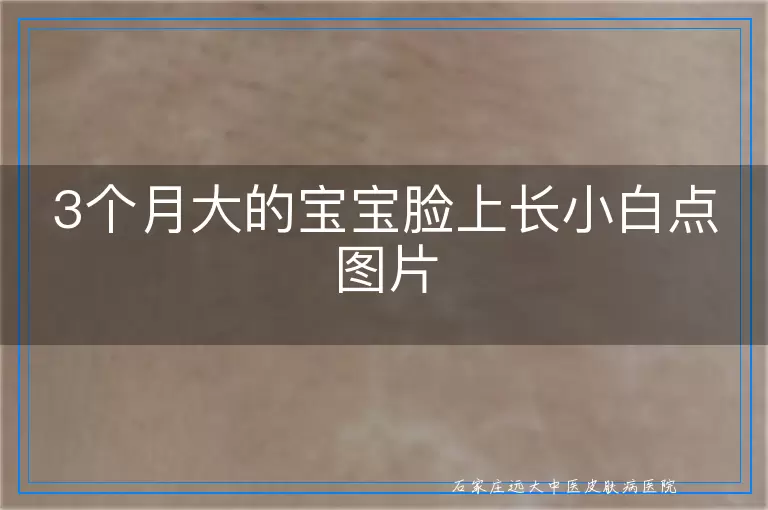 3个月大的宝宝脸上长小白点图片
