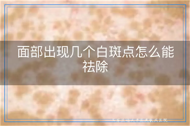 面部出现几个白斑点怎么能祛除