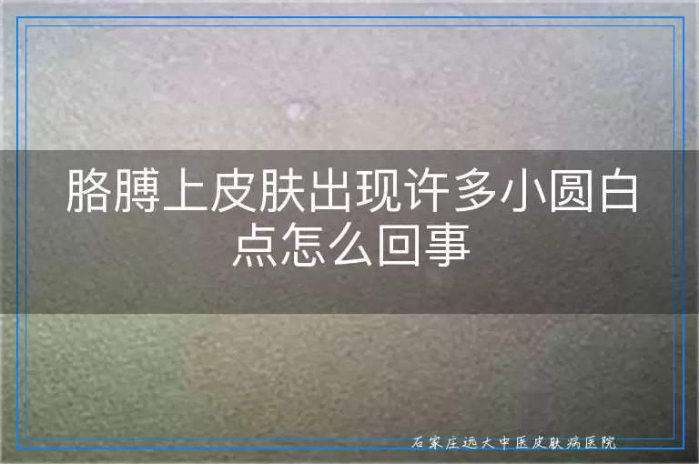 胳膊上皮肤出现许多小圆白点怎么回事