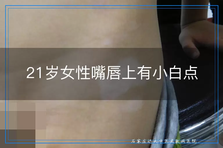 21岁女性嘴唇上有小白点