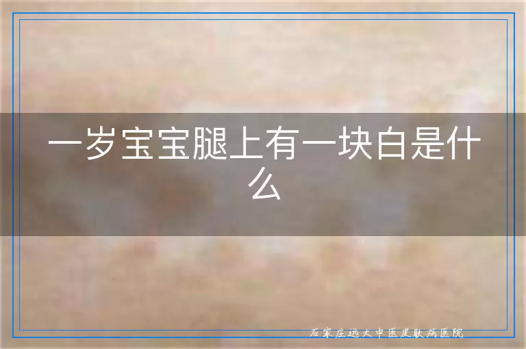 一岁宝宝腿上有一块白是什么