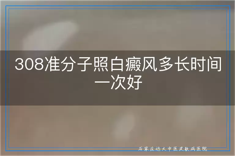 308准分子照白癜风多长时间一次好