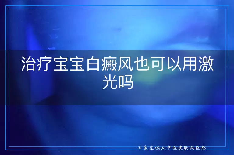 治疗宝宝白癜风也可以用激光吗