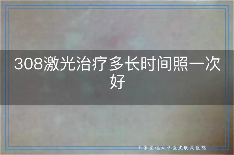 308激光治疗多长时间照一次好