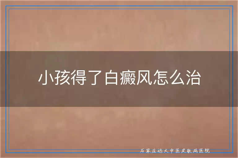 小孩得了白癜风怎么治