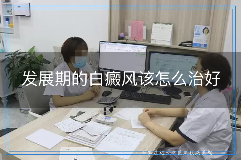 发展期的白癜风该怎么治好