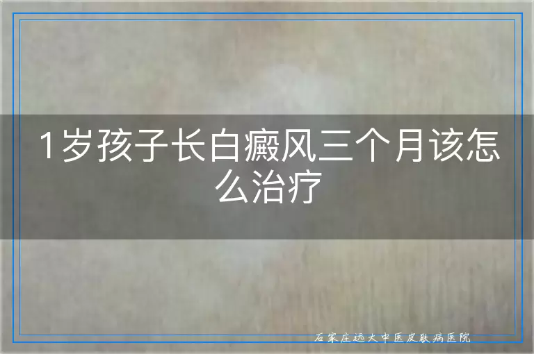 1岁孩子长白癜风三个月该怎么治疗