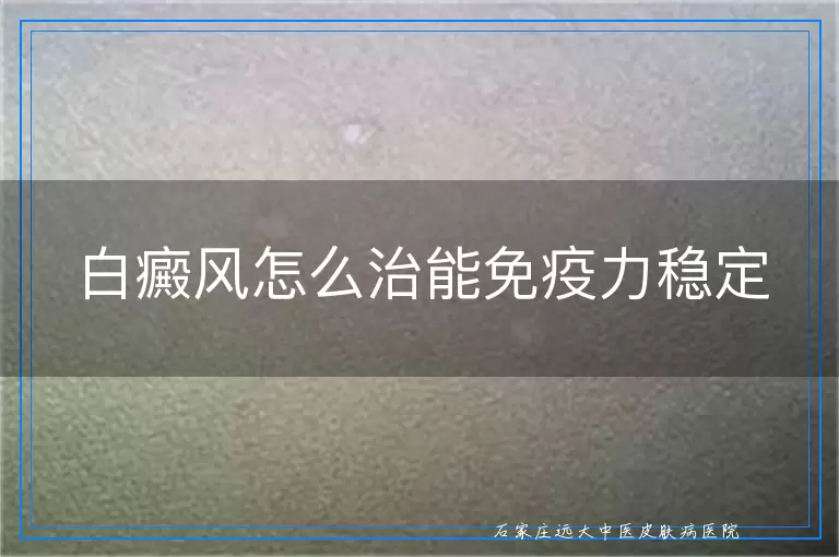 白癜风怎么治能免疫力稳定