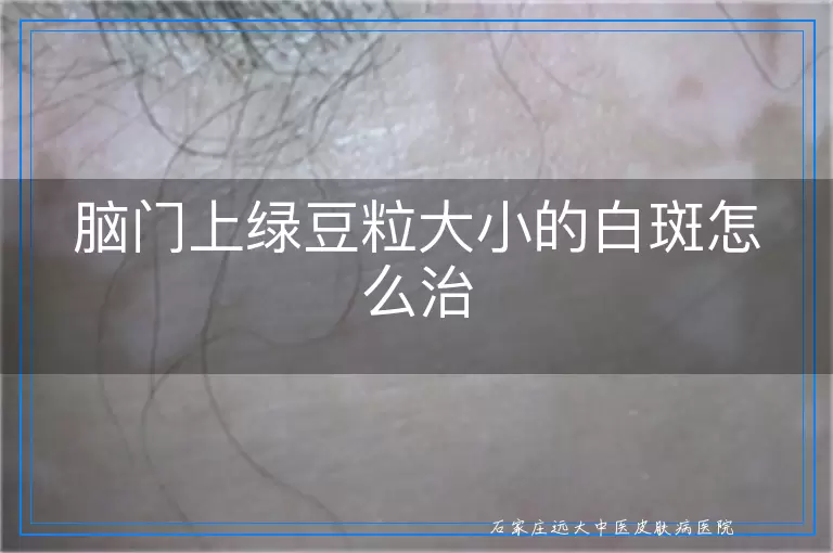 脑门上绿豆粒大小的白斑怎么治