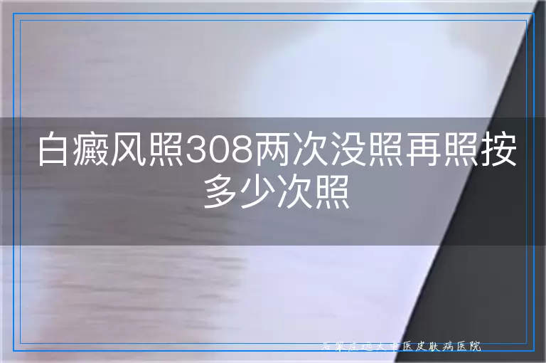白癜风照308两次没照再照按多少次照